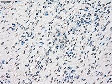 RAD9A / RAD9 Antibody - IHC of paraffin-embedded Ovary tissue using anti-RAD9A mouse monoclonal antibody. (Dilution 1:50).