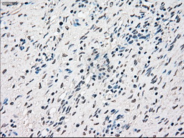 RAD9A / RAD9 Antibody - IHC of paraffin-embedded Ovary tissue using anti-RAD9A mouse monoclonal antibody. (Dilution 1:50).