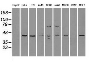 RAD9A / RAD9 Antibody - Western blot of extracts (35 ug) from 9 different cell lines by using anti-anti-RAD9Amonoclonal antibody.