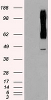 RAD9A / RAD9 Antibody - HEK293T cells were transfected with the pCMV6-ENTRY control (Left lane) or pCMV6-ENTRY RAD9A (Right lane) cDNA for 48 hrs and lysed. Equivalent amounts of cell lysates (5 ug per lane) were separated by SDS-PAGE and immunoblotted with anti-RAD9A.