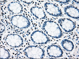 RAD9A / RAD9 Antibody - Immunohistochemical staining of paraffin-embedded colon tissue using anti-RAD9A mouse monoclonal antibody. (Dilution 1:50).
