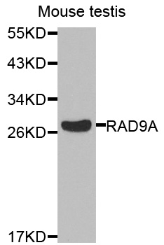 RAD9A / RAD9 Antibody - Western blot analysis of extracts of mouse heart cells.