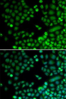 RAD9A / RAD9 Antibody - Immunofluorescence analysis of MCF7 cells.