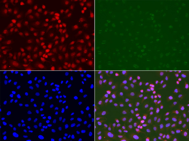 RAD9A / RAD9 Antibody - Immunofluorescence analysis of U2OS cells.