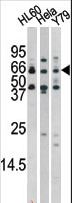 RAD9A / RAD9 Antibody - The anti-Phospho-Rad9-S272 antibody is used in Western blot to detect Phospho-Rad9-S272 in HL60 (left), HeLa(middle), and Y79(right)tissue lysates.