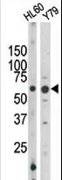 RAD9A / RAD9 Antibody - The anti-Phospho-Rad9-S328 antibody is used in Western blot to detect Phospho-Rad9-S328 in HL60 (left) and Y79 (right) tissue lysates.