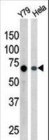 RAD9A / RAD9 Antibody - The anti-Phospho-Rad9-S387 antibody is used in Western blot to detect Phospho-Rad9-S387 in Y79 (left) and HeLa (right) tissue lysate
