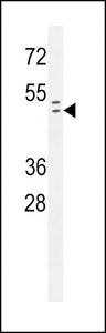 RAD9A / RAD9 Antibody - Rad9 Antibody (pS387) western blot of 293 cell line lysates (35 ug/lane). The Rad9 antibody detected the Rad9 protein (arrow).