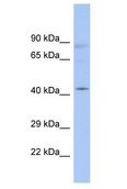 RAD9B Antibody - RAD9B antibody Western Blot of Fetal Thymus. Antibody dilution: 1 ug/ml.  This image was taken for the unconjugated form of this product. Other forms have not been tested.