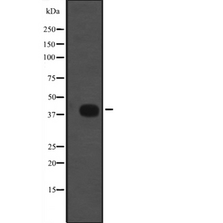 RAD9B Antibody - Western blot analysis of RAD9B expression in human fetal thymus lysate. The lane on the left is treated with the antigen-specific peptide.