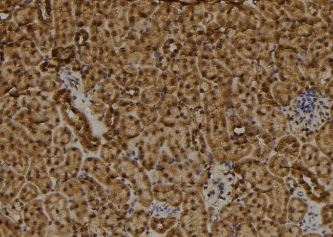 RAD9B Antibody - 1:100 staining mouse kidney tissue by IHC-P. The sample was formaldehyde fixed and a heat mediated antigen retrieval step in citrate buffer was performed. The sample was then blocked and incubated with the antibody for 1.5 hours at 22°C. An HRP conjugated goat anti-rabbit antibody was used as the secondary.