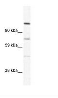Radil Antibody - SP2/0 Cell Lysate.  This image was taken for the unconjugated form of this product. Other forms have not been tested.
