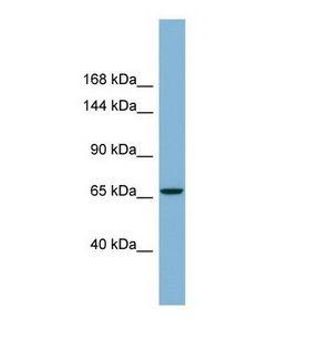 Radil Antibody - Western blot of Human NCI-H227. RADIL antibody dilution 1.0 ug/ml.  This image was taken for the unconjugated form of this product. Other forms have not been tested.