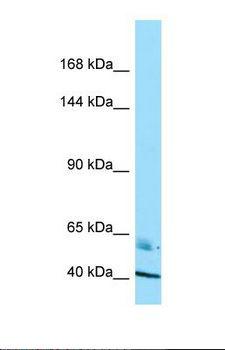 Radil Antibody - Western blot of Human OVCAR-3. RADIL antibody dilution 1.0 ug/ml.  This image was taken for the unconjugated form of this product. Other forms have not been tested.