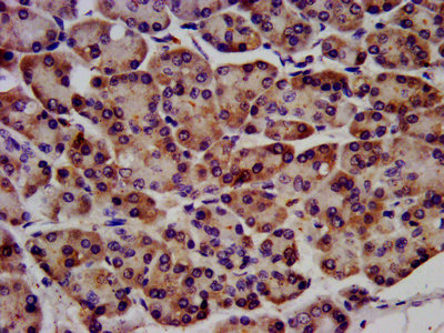 RAF1 / RAF Antibody - IHC image of RAF1 Antibody diluted at 1:1200 and staining in paraffin-embedded human pancreatic tissue performed on a Leica BondTM system. After dewaxing and hydration, antigen retrieval was mediated by high pressure in a citrate buffer (pH 6.0). Section was blocked with 10% normal goat serum 30min at RT. Then primary antibody (1% BSA) was incubated at 4°C overnight. The primary is detected by a biotinylated secondary antibody and visualized using an HRP conjugated SP system.
