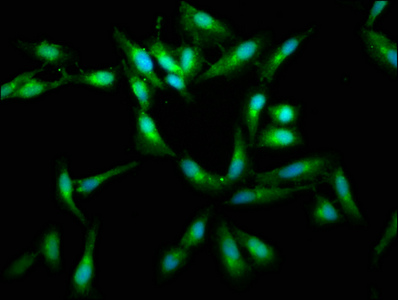 RAF1 / RAF Antibody - Immunofluorescence staining of Hela cells with RAF1 Antibody at 1:400, counter-stained with DAPI. The cells were fixed in 4% formaldehyde, permeabilized using 0.2% Triton X-100 and blocked in 10% normal Goat Serum. The cells were then incubated with the antibody overnight at 4°C. The secondary antibody was Alexa Fluor 488-congugated AffiniPure Goat Anti-Rabbit IgG(H+L).