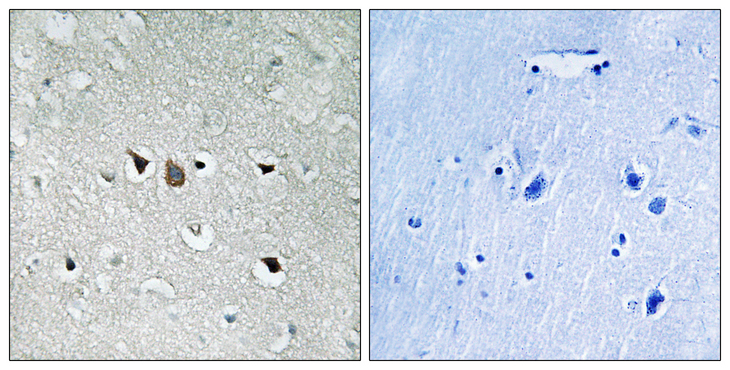 RAF1 / RAF Antibody - Immunohistochemistry analysis of paraffin-embedded human brain tissue, using C-RAF Antibody. The picture on the right is blocked with the synthesized peptide.