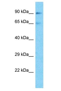 RAF1 / RAF Antibody - RAF1 / RAF antibody Western Blot of Jurkat. Antibody dilution: 1 ug/ml.  This image was taken for the unconjugated form of this product. Other forms have not been tested.