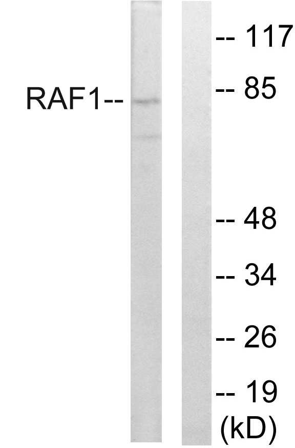 RAF1 / RAF Antibody - Western blot analysis of lysates from rat liver cells, using C-RAF Antibody. The lane on the right is blocked with the synthesized peptide.