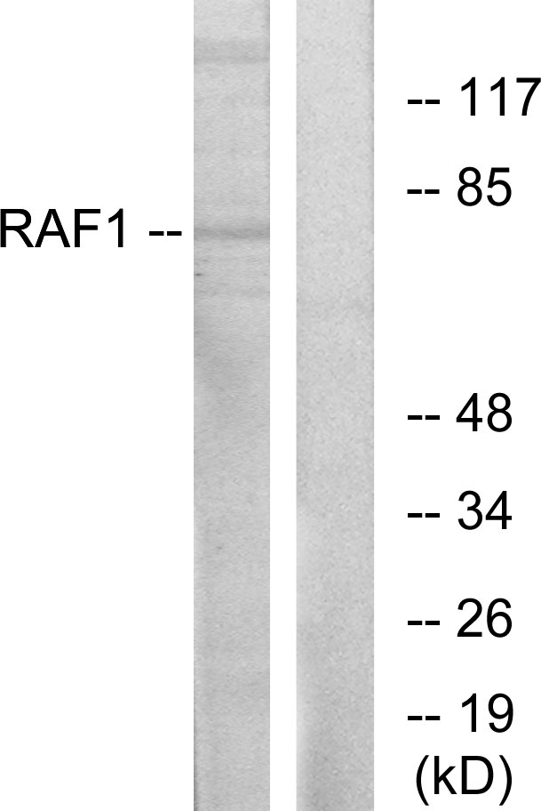 RAF1 / RAF Antibody - Western blot analysis of lysates from HT-29 cells, using C-RAF Antibody. The lane on the right is blocked with the synthesized peptide.