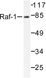 RAF1 / RAF Antibody - Western blot of Raf1 (Q253) pAb in extracts from K562 MDA-MB-435 cells.