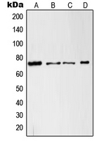 RAF1 / RAF Antibody - Western blot analysis of c-RAF expression in A431 (A); HeLa (B); RAW264.7 (C); C6 (D) whole cell lysates.