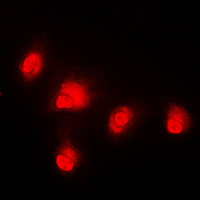 RAF1 / RAF Antibody - Immunofluorescent analysis of c-RAF staining in HeLa cells. Formalin-fixed cells were permeabilized with 0.1% Triton X-100 in TBS for 5-10 minutes and blocked with 3% BSA-PBS for 30 minutes at room temperature. Cells were probed with the primary antibody in 3% BSA-PBS and incubated overnight at 4 C in a humidified chamber. Cells were washed with PBST and incubated with a DyLight 594-conjugated secondary antibody (red) in PBS at room temperature in the dark. DAPI was used to stain the cell nuclei (blue).