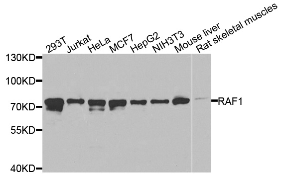 RAF1 / RAF Antibody - Western blot analysis of extracts of various cell lines, using RAF1 antibody at 1:1000 dilution. The secondary antibody used was an HRP Goat Anti-Rabbit IgG (H+L) at 1:10000 dilution. Lysates were loaded 25ug per lane and 3% nonfat dry milk in TBST was used for blocking.