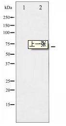 RAF1 / RAF Antibody - Western blot of C-RAF expression in UV treated HeLa whole cell lysates,The lane on the left is treated with the antigen-specific peptide.