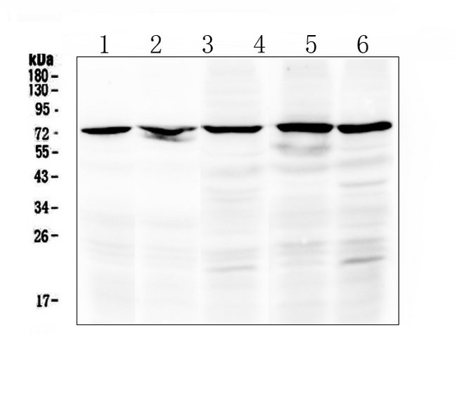 RAF1 / RAF Antibody - Western blot analysis of Raf1 using anti-Raf1 antibody. Electrophoresis was performed on a 5-20% SDS-PAGE gel at 70V (Stacking gel) / 90V (Resolving gel) for 2-3 hours. The sample well of each lane was loaded with 50ug of sample under reducing conditions. Lane 1: rat kidney tissue lysate,Lane 2: mouse kidney tissue lysate,Lane 3: human MCF-7 whole cell lysate,Lane 4: human 22RV1 whole cell lysate,Lane 5: human Hela whole cell lysate. After Electrophoresis, proteins were transferred to a Nitrocellulose membrane at 150mA for 50-90 minutes. Blocked the membrane with 5% Non-fat Milk/ TBS for 1.5 hour at RT. The membrane was incubated with rabbit anti-Raf1 antigen affinity purified polyclonal antibody at 0.5 µg/mL overnight at 4°C, then washed with TBS-0.1% Tween 3 times with 5 minutes each and probed with a goat anti-rabbit IgG-HRP secondary antibody at a dilution of 1:10000 for 1.5 hour at RT. The signal is developed using an Enhanced Chemiluminescent detection (ECL) kit with Tanon 5200 system. A specific band was detected for Raf1 at approximately 73KD. The expected band size for Raf1 is at 73KD.