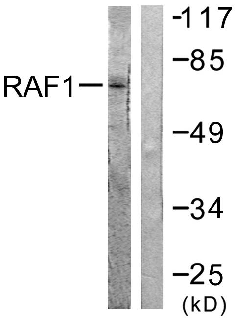 RAF1 / RAF Antibody - Western blot analysis of extracts from HeLa cells, treated with UV (5mins), using Raf1 (Ab-621) antibody.