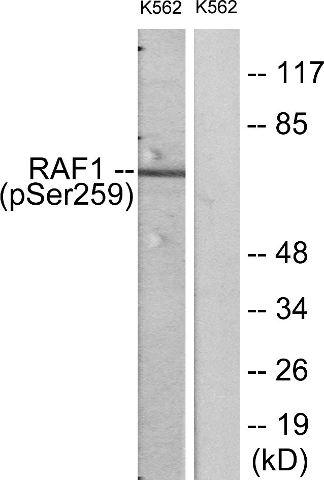 RAF1 / RAF Antibody - Western blot analysis of lysates from K562 cells, using C-RAF (Phospho-Ser259) Antibody. The lane on the right is blocked with the phospho peptide.