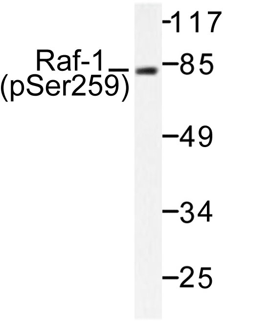 RAF1 / RAF Antibody - Western blot of p-Raf1 (S259) pAb in extracts from K562 cells.