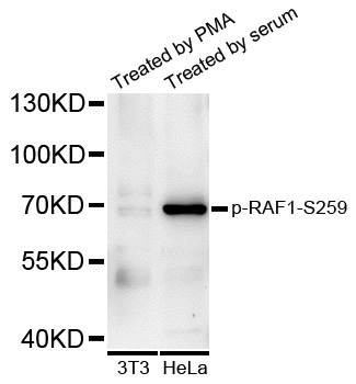 RAF1 / RAF Antibody - Western blot analysis of extracts of various cell lines.