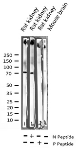 RAF1 / RAF Antibody - Western blot analysis of Phospho-C-RAF (Ser259) expression in various lysates