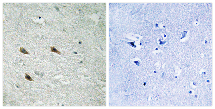 RAF1 / RAF Antibody - Immunohistochemistry analysis of paraffin-embedded human brain, using C-RAF (Phospho-Ser289) Antibody. The picture on the right is blocked with the phospho peptide.