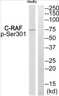 RAF1 / RAF Antibody - Western blot of extracts from HUVEC, using C-RAF (Phospho-Ser301) Antibody.