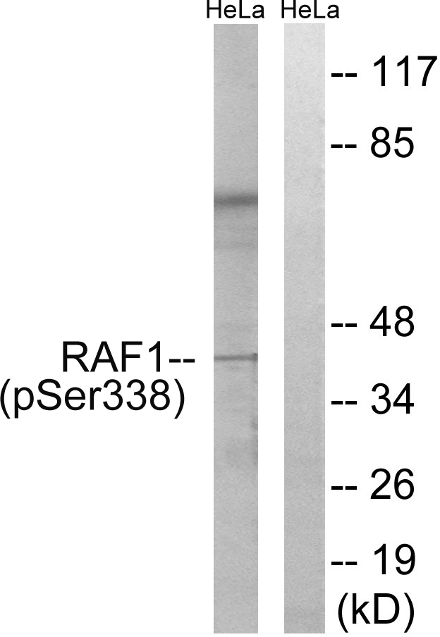RAF1 / RAF Antibody - Western blot analysis of lysates from HeLa cells treated with paclitaxel 1uM 24h, using C-RAF (Phospho-Ser338) Antibody. The lane on the right is blocked with the phospho peptide.