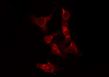 RAF1 / RAF Antibody - Staining HeLa cells by IF/ICC. The samples were fixed with PFA and permeabilized in 0.1% Triton X-100, then blocked in 10% serum for 45 min at 25°C. The primary antibody was diluted at 1:200 and incubated with the sample for 1 hour at 37°C. An Alexa Fluor 594 conjugated goat anti-rabbit IgG (H+L) Ab, diluted at 1/600, was used as the secondary antibody.