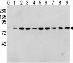 RAF1 / RAF Antibody - Western blot of Phospho-RAF1-pS338 Antibody in human TPA activated HeLa cell line lysates. Phospho-RAF1 (arrow) was detected using the purified antibody. (0: without TPA; 1: 60 ug/ml TPA, 15min; 2: 60 ug/ml TPA, 30min; 3: 60 ug/ml TPA, 45min; 4: 125 ug/ml TPA, 15min; 5: 125 ug/ml TPA, 30min; 6: 125 ug/ml TPA, 45min; 7: 250 ug/ml TPA, 15min; 8: 250 ug/ml TPA, 30min; 9: 250 ug/ml, 45min)
