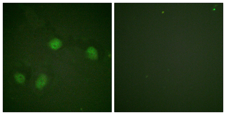 RAF1 / RAF Antibody - Immunofluorescence analysis of HeLa cells, using C-RAF (Phospho-Ser621) Antibody. The picture on the right is blocked with the phospho peptide.