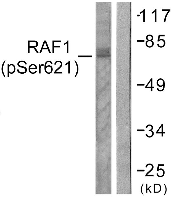 RAF1 / RAF Antibody - Western blot analysis of lysates from HeLa cells treated with UV 5', using C-RAF (Phospho-Ser621) Antibody. The lane on the right is blocked with the phospho peptide.