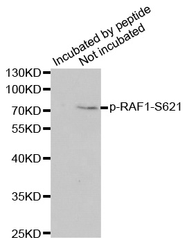 RAF1 / RAF Antibody - Western blot analysis of extracts of HeLa cellss treated by UV.