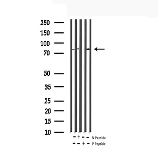 RAF1 / RAF Antibody - Western blot analysis of Phospho-C-RAF (Ser621) expression in various lysates