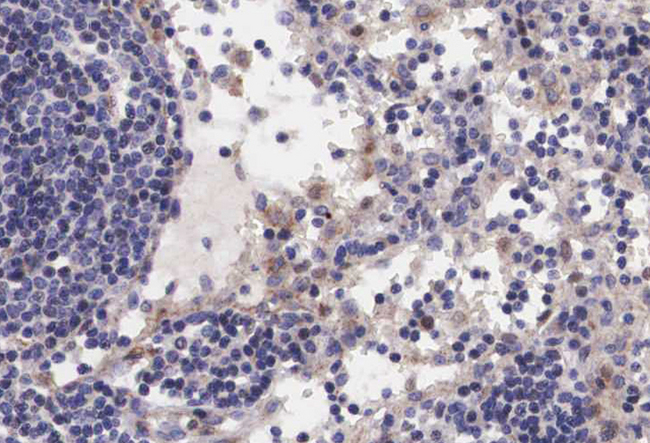 RAF1 / RAF Antibody - 1:200 staining human lymph node tissue by IHC-P. The tissue was formaldehyde fixed and a heat mediated antigen retrieval step in citrate buffer was performed. The tissue was then blocked and incubated with the antibody for 1.5 hours at 22°C. An HRP conjugated goat anti-rabbit antibody was used as the secondary.