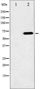 RAF1 / RAF Antibody - Western blot analysis of C-RAF phosphorylation expression in UV treated HeLa whole cells lysates. The lane on the left is treated with the antigen-specific peptide.