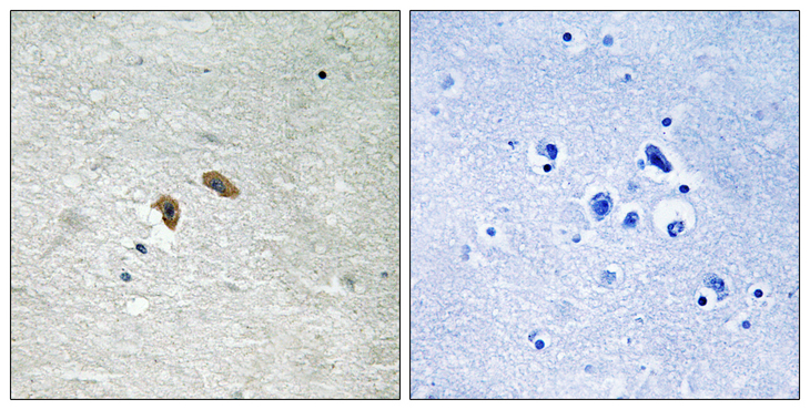 RAF1 / RAF Antibody - Immunohistochemistry analysis of paraffin-embedded human brain, using C-RAF (Phospho-Thr269) Antibody. The picture on the right is blocked with the phospho peptide.