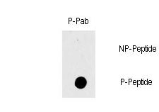 RAF1 / RAF Antibody - Dot blot of Phospho-RAF1-T269 polyclonal antibody on nitrocellulose membrane. 50ng of Phospho-peptide or Non Phospho-peptide per dot were adsorbed. Antibody working concentration was 0.5ug per ml. P-antibody: phospho-antibody; P-Peptide: phospho-peptide; NP-Peptide: non-phospho-peptide.