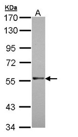 RAG2 / RAG-2 Antibody - Sample (30 ug of whole cell lysate). A: Molt-4 . 7.5% SDS PAGE. RAG2 / RAG-2 antibody diluted at 1:1000.