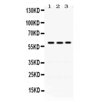 RAG2 / RAG-2 Antibody - RAG2 antibody Western blot. All lanes: Anti RAG2 at 0.5 ug/ml. Lane 1: A549 Whole Cell Lysate at 40 ug. Lane 2: 22RV1 Whole Cell Lysate at 40 ug. Lane 3: U20S Whole Cell Lysate at 40 ug. Predicted band size: 59 kD. Observed band size: 59 kD.